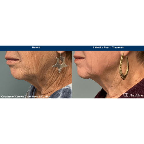 Beforeafter-Biesman-PDF-1 copy