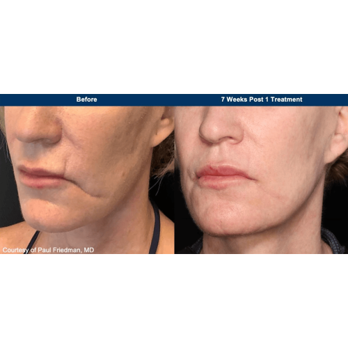 e21ae55a-ad76-479e-aa23-a6e8b36dbb80